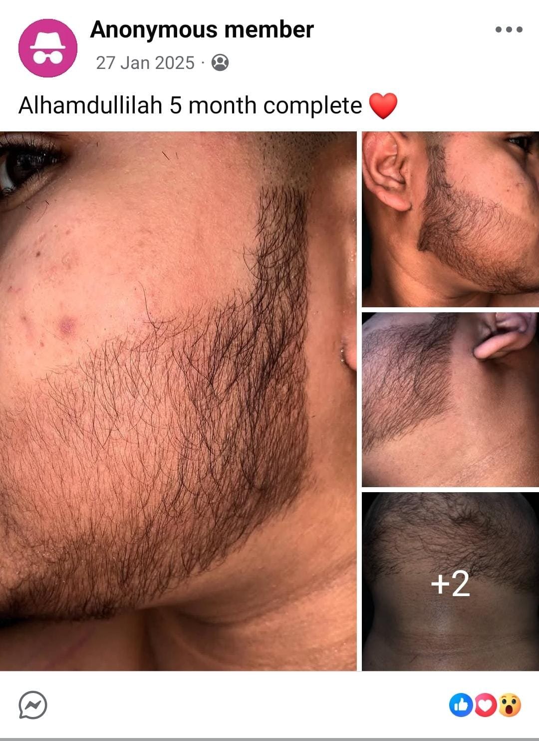 WhatsApp Image 2026-02-21 at 1.31.05 AM